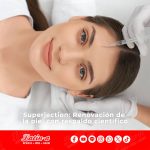 Superjection: Renovación de la piel con respaldo científico