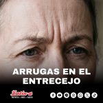 Arrugas del entrecejo