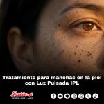 Tratamiento para manchas en la piel con Luz Pulsada IPL